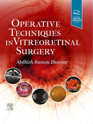 cover image of Operative Techniques in Vitreoretinal Surgery E-Book